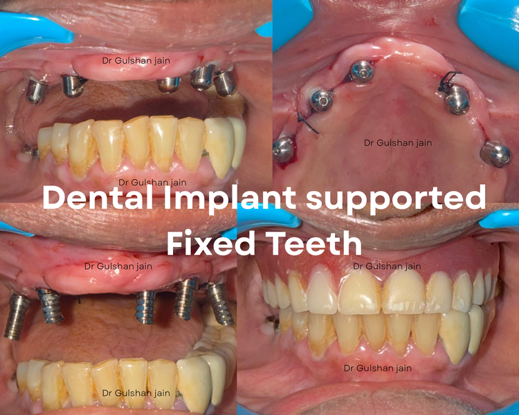 Cover photo of Napier Town Dental Hub (Dr Gulshan Jain MDS)