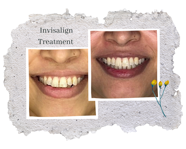 Cover photo of Dr Gulshan Jain MDS ( Napier Town Dental Hub )